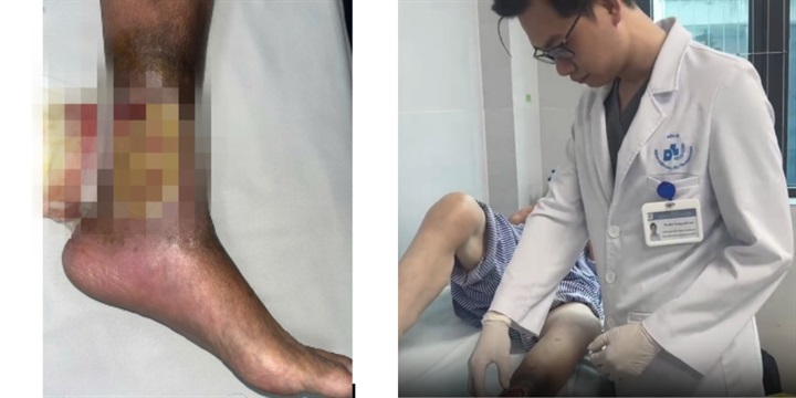 Tình trạng trước khi nhập viện của bệnh nhân trước khi nhập viện (ảnh trái) và sau khi được cải thiện tình trạng (ảnh phải). Ảnh: BVCC