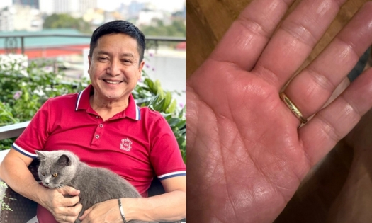 NSƯT Chí Trung mắc bệnh lạ hơn 6 tháng
